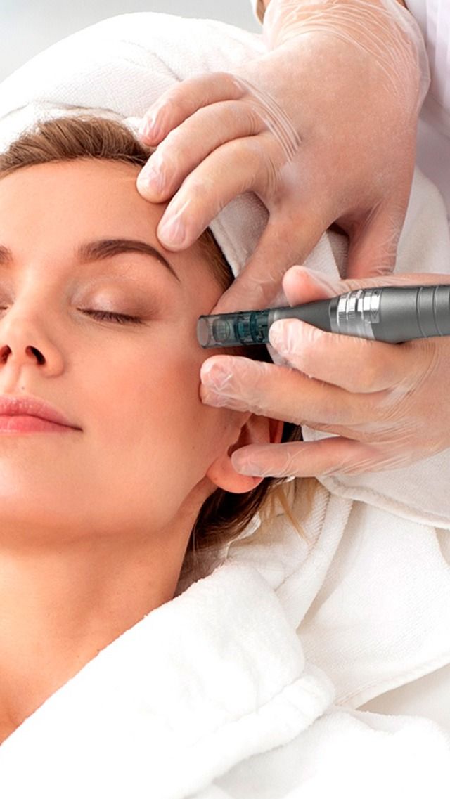 Potenza™ RF Microneedling: The Ultimate Guide to Firmer, Smoother, and Healthier Skin