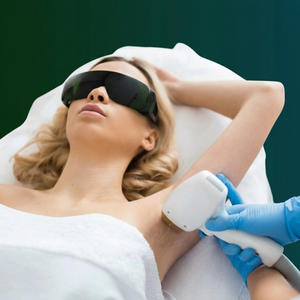 3 Full Body Laser Hair Removal