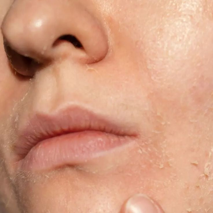 Dull & Dehydrated Skin Consultation