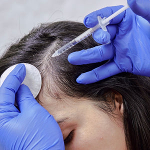 Advanced Hair Restoration & Hormonal Alopecia Therapy