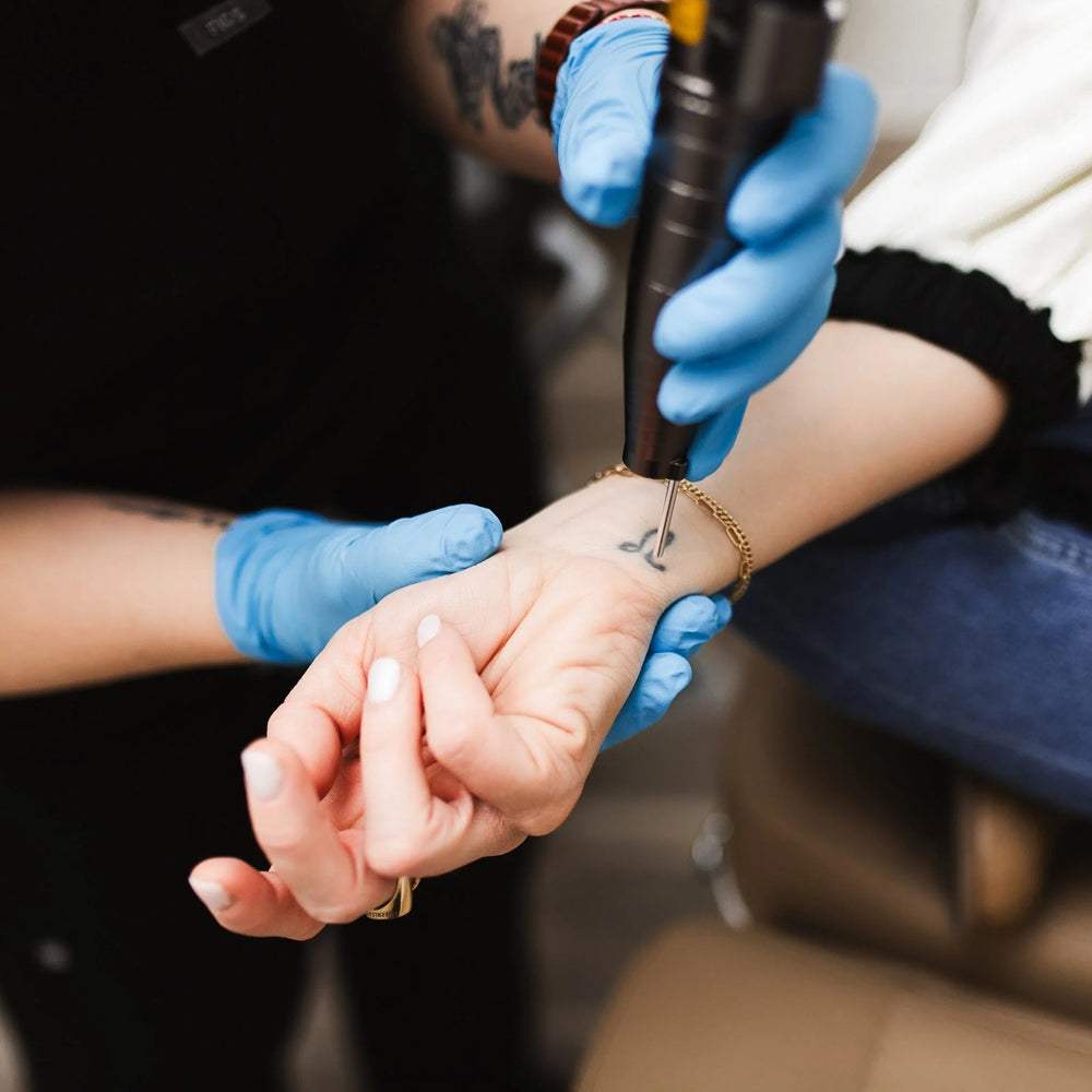 Spectra™ Laser Tattoo Removal – Advanced Q-Switched Multi-Color Ink Removal System