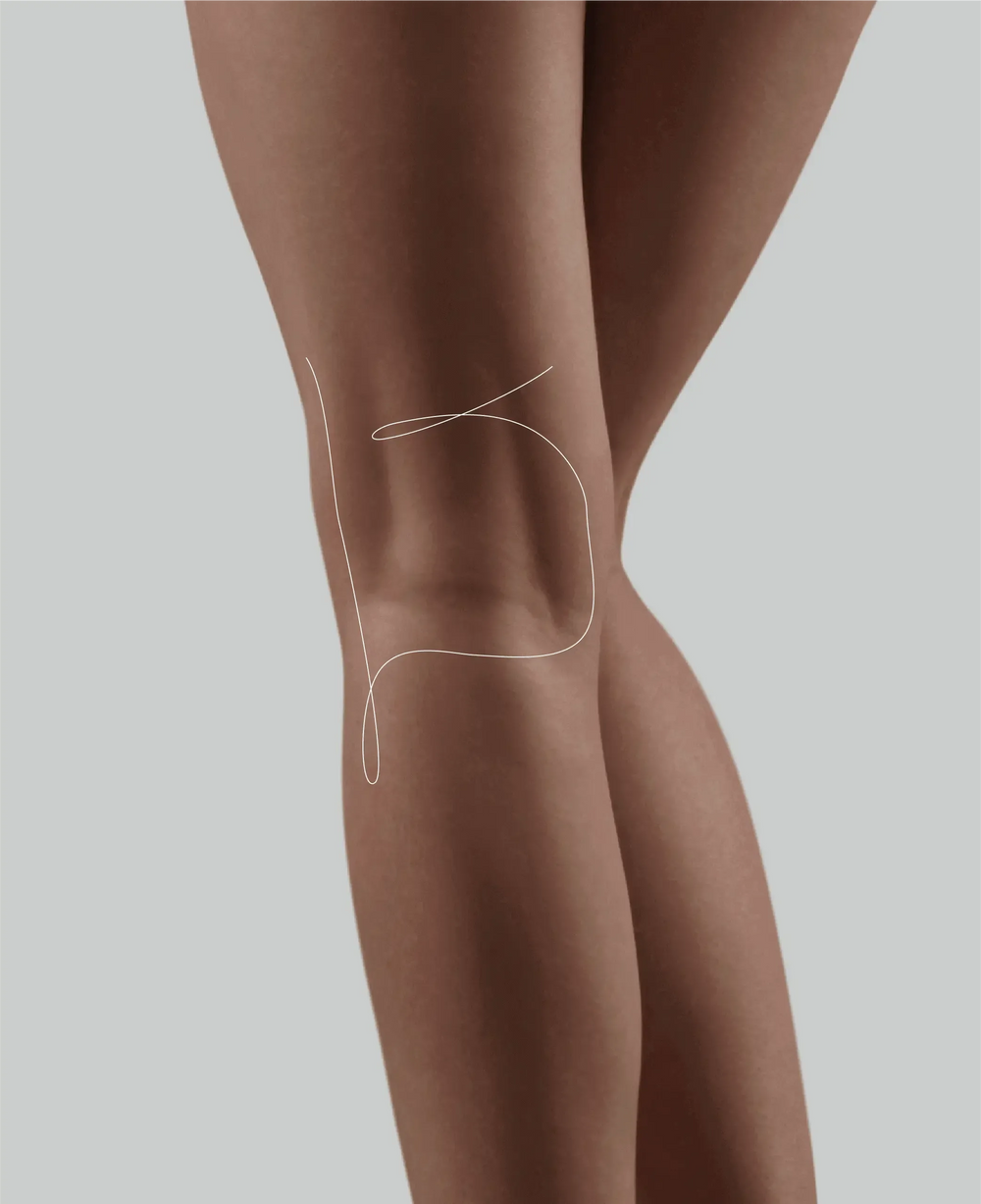 HYAcorp MLF 1 (10ml) – Body Contouring & Volumizing Hyaluronic Acid Filler