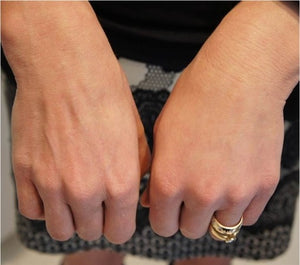 PLABAZ01 PLLA Body Filler (10ml) – Advanced Collagen Stimulator & Volumizer