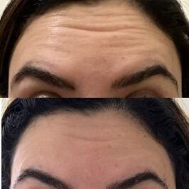 YAQOOT 5 mL Biomodulator Booster