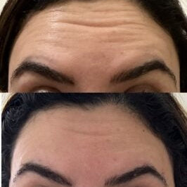 YAQOOT 2.5 mL Biomodulator Booster