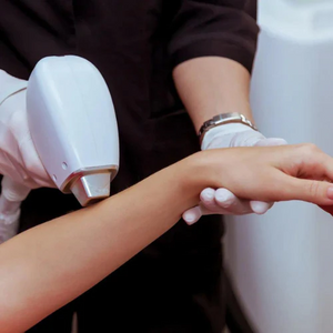 Half Hand Laser Hair Removal
