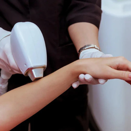 Half Hand Laser Hair Removal