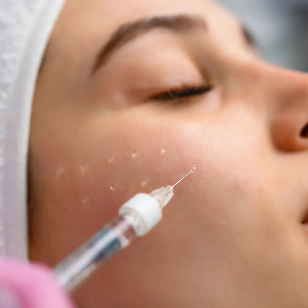 Potenza™ RF + PDRN 2.5% (Salmon DNA) – Advanced Cellular Repair & Glass Skin Glow